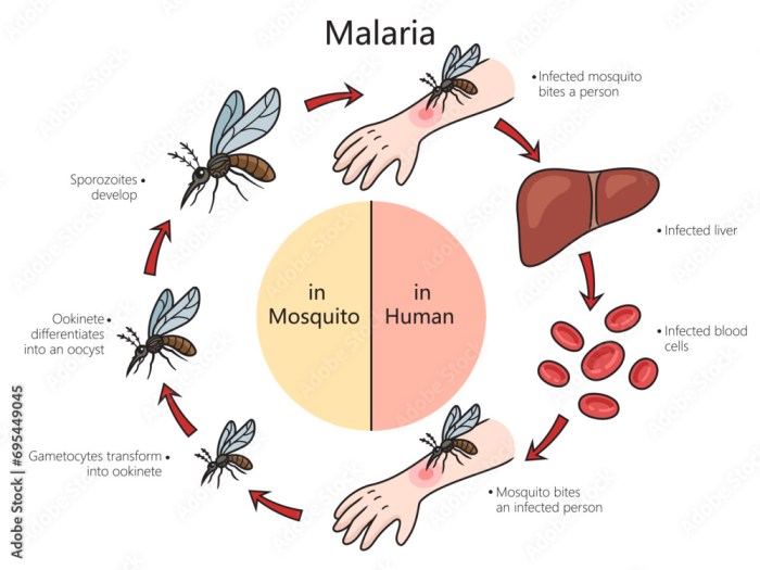 Malaria disease diagram hand drawn schematic vector illustration ...