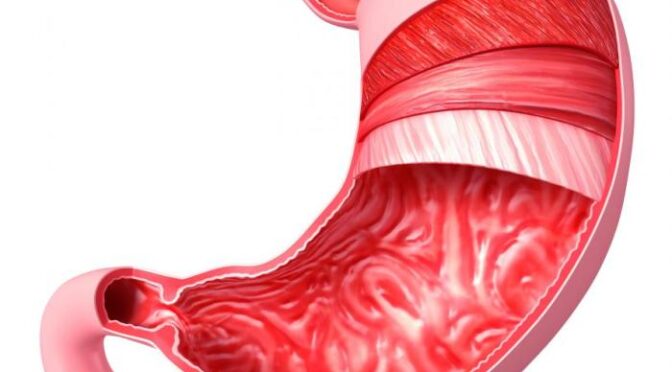 Stomach Cancer Awareness Symptoms You Shouldnt Ignore