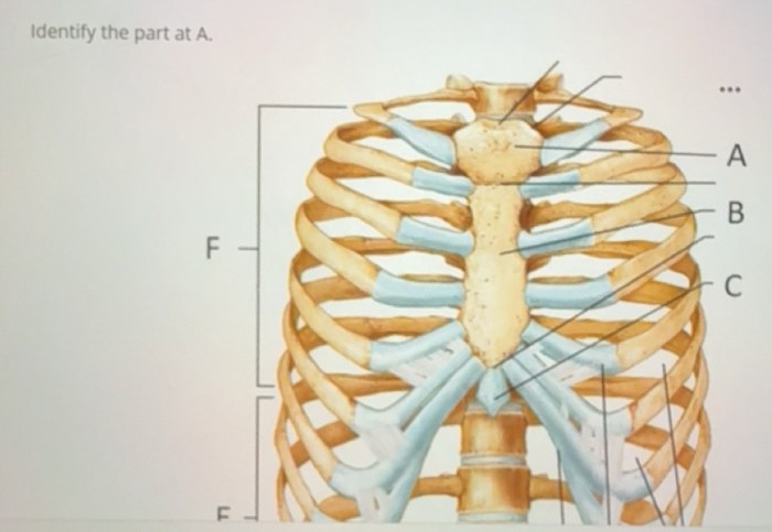 Solved: Identify the part at A. F [Math]