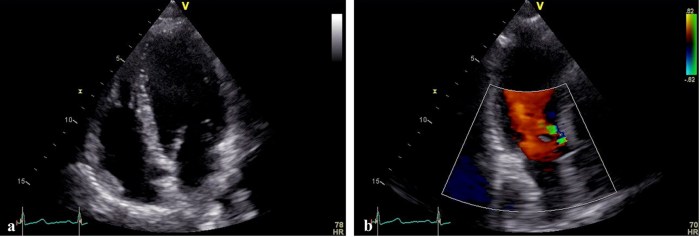 South Sudan’s men’s basketball team on the cusp of FIBA World Cup ...